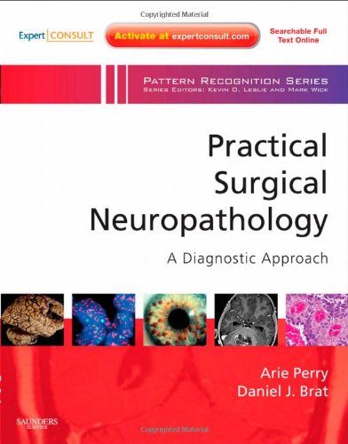 Practical Surgical Neuropathology: A Diagnostic Approach